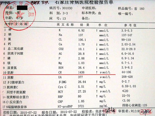 肌酐七百多能定为尿毒症吗?尿毒症尿毒症病人