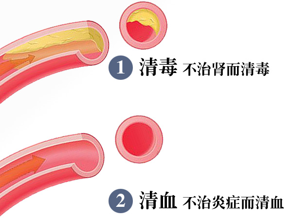 尿毒症中医治疗方法：三肾清毒(图)