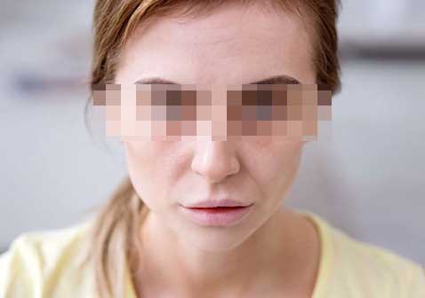 白血病瘀斑与普通瘀斑的区别皮肤苍白图片