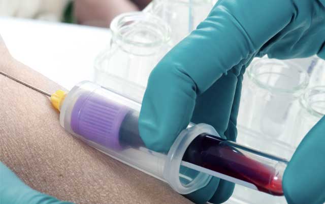 尿毒症早期症状表现有哪些