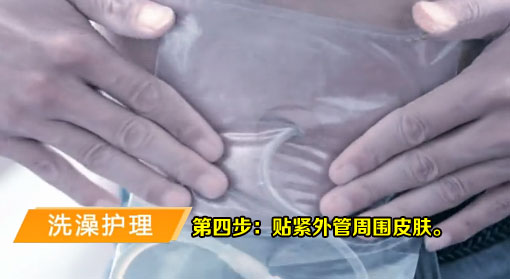 腹膜透析洗澡护理-第四步：贴紧外管周围皮肤。