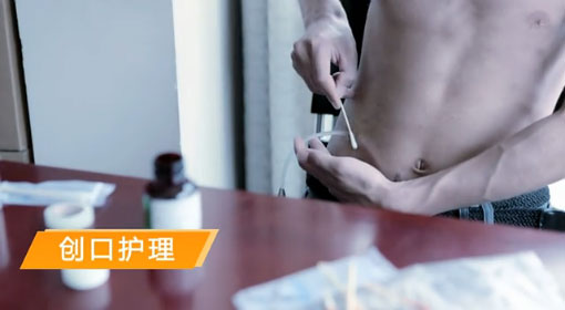  尿毒症腹膜透析患者创口护理