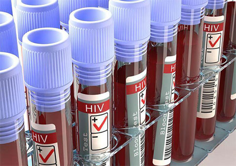 艾滋病窗口期检测