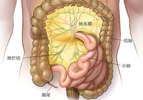 肠系膜淋巴结炎图示