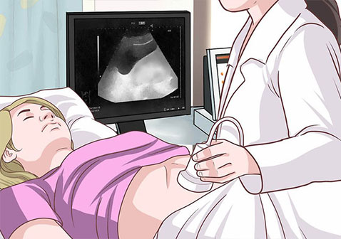 多囊肝多囊肾是什么原因引起的？