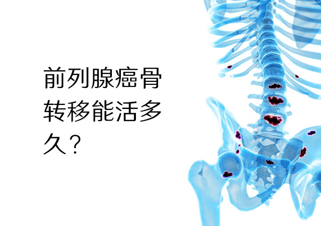 前列腺癌骨转移能活多久？