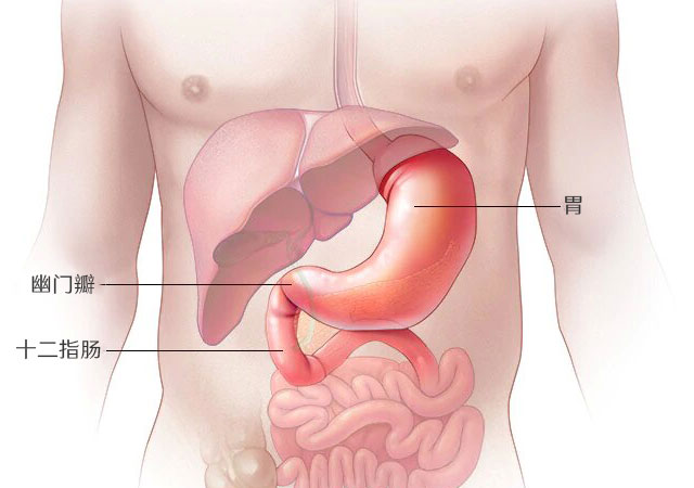 倾倒综合征：胃和幽门瓣膜