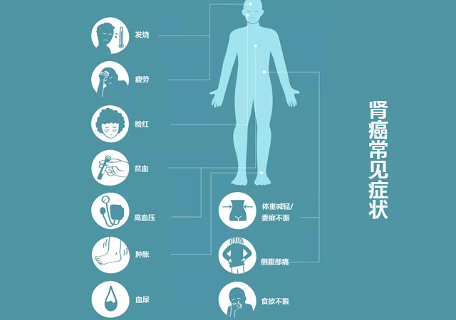 肾癌肾肿瘤常见症状