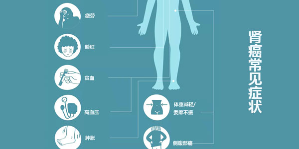 肾癌肾肿瘤常见体征症状转移症状罕见特殊症状和并发症