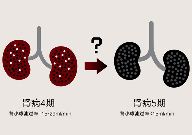 肾病4期到肾病5期要多久