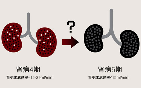 从慢性肾病4期到肾病5期需要多长时间？
