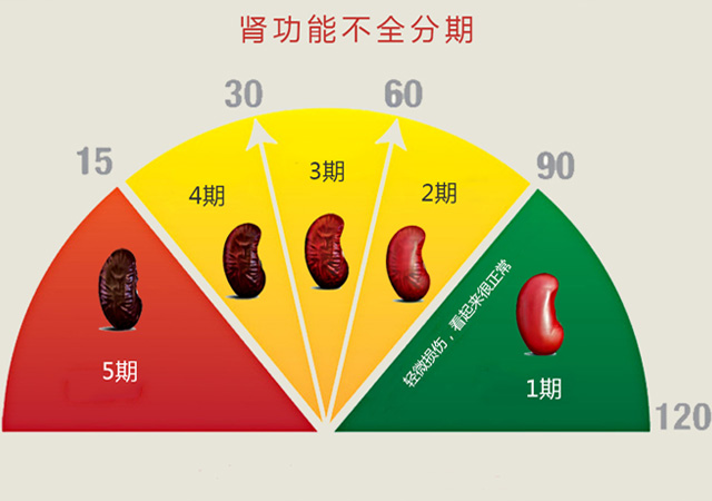 肾功能不全5期图表