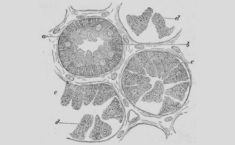什么肾混浊肿胀图片说明？