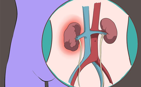 肾结石的危害有哪些？