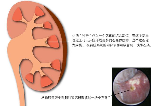 成核阶段