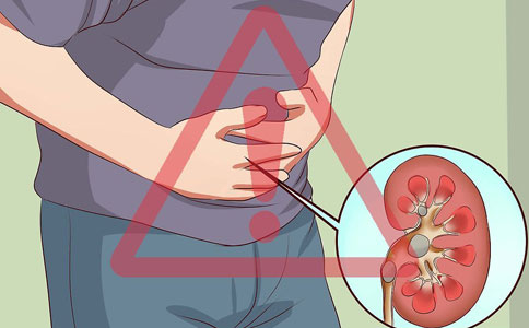 肾结石有多严重，会严重到死亡吗？