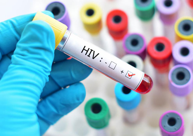 艾滋病病毒和艾滋病血液检测