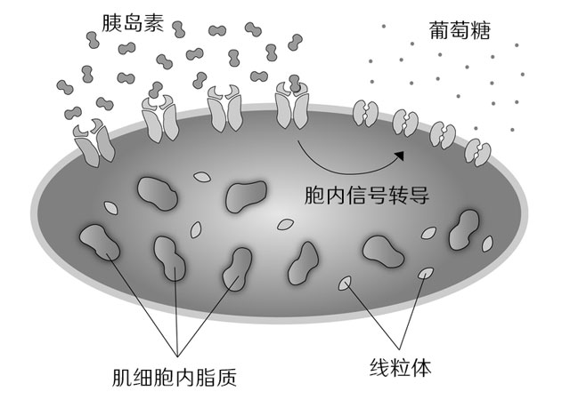 糖尿病的真正原因