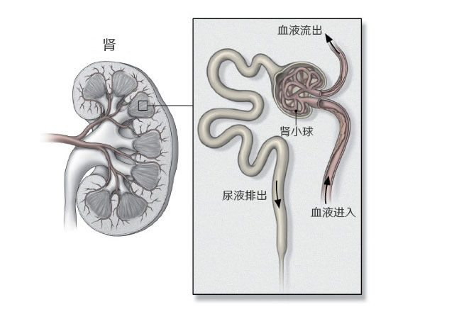 糖尿病肾病早期表现