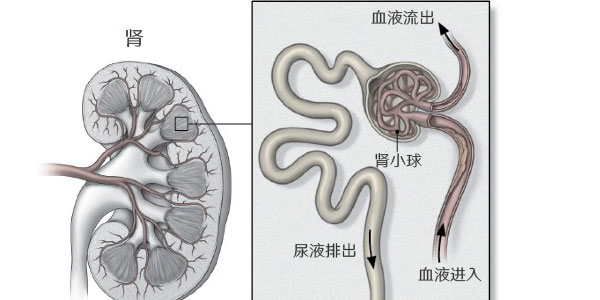 糖尿病肾病早期症状表现治疗