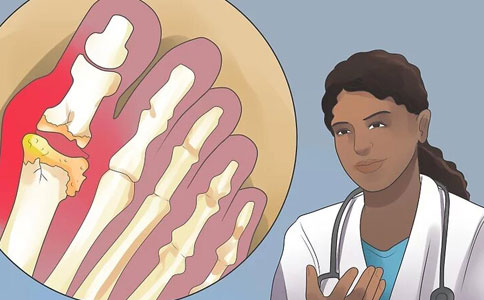 导致血液中尿酸高的原因是什么？