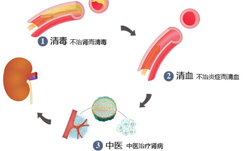 尿毒症如何治疗？换了好几家医院效果不好还越治越严重