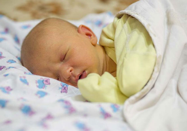 母乳喂养婴儿出现黄疸