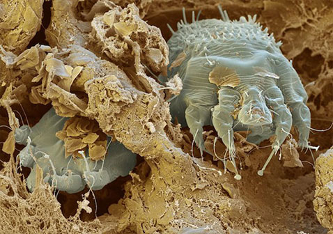显微镜下皮肤疥虫的样子图片