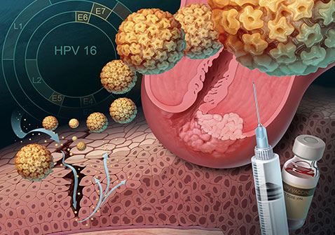hpv疫苗作用图片