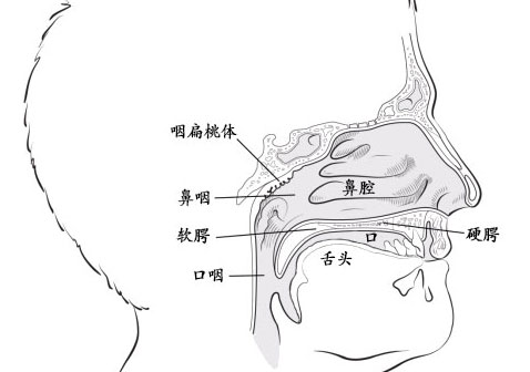 鼻咽癌示意图片