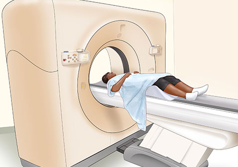 鼻咽癌怎么确诊CT扫描图片