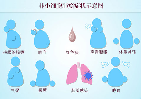 非小细胞肺癌症状图片