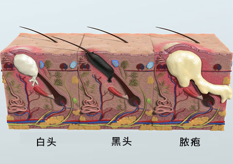 头上长疙瘩图片