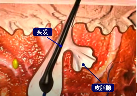 头上长疙瘩形成过程正常图片