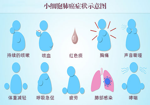 小细胞肺癌症状图片