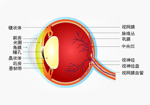 视网膜色素变性示意图片