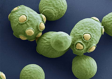 阴囊瘙痒是什么原因造成的图片酵母菌