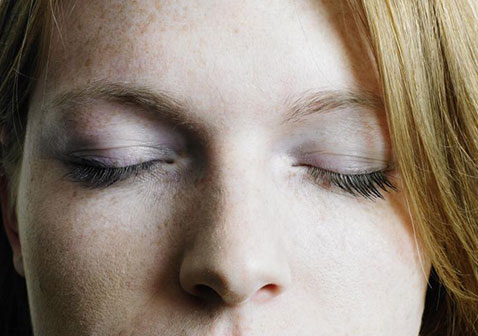 引起脸上长白斑的原因特发性点状色素减少症图片