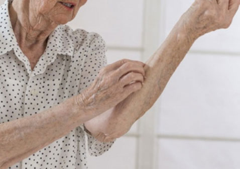 女性老年瘙痒症的症状图片