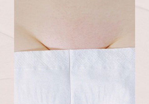 女性外阴湿疹图片初期症状图片