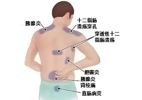 背部疼痛图解大全2
