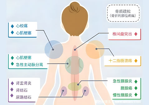 背部疼痛图解大全