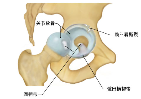 髋臼唇图片