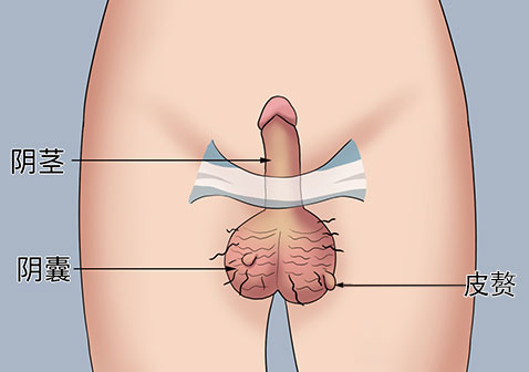 男性生殖器长皮赘图片