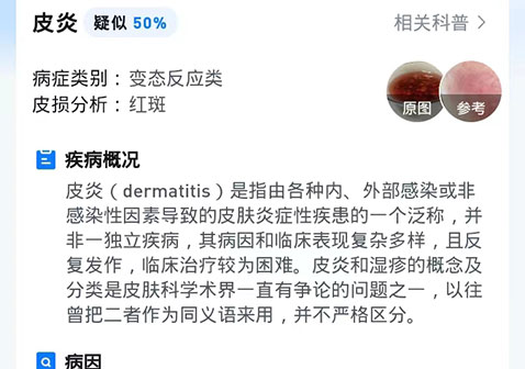 微信皮肤病在线拍照自测步骤7