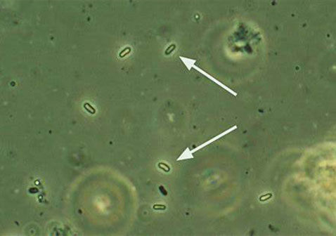 微孢子虫病图片