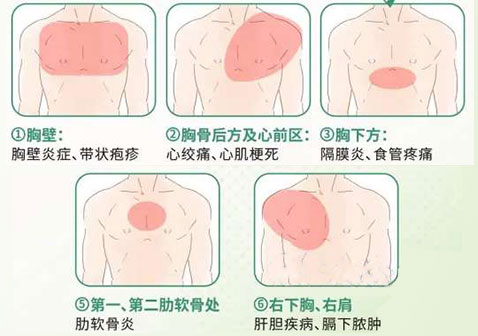 胸口疼痛部位对照表图解