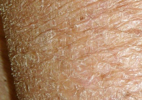 睾丸皮有毛屑图片